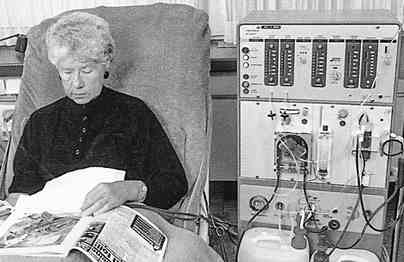 L'histoire de la dialyse